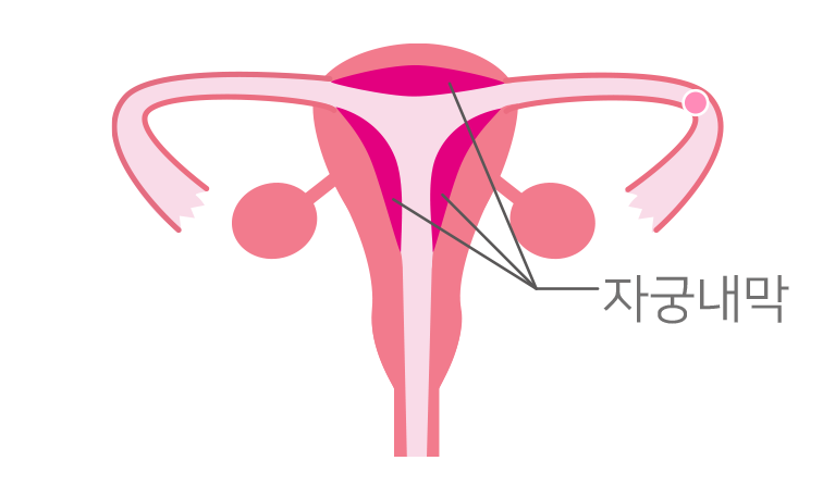 자궁내막이 푹신해져요