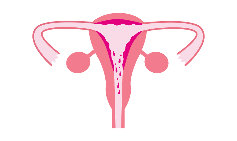 자궁내막이 벗겨지면서 몸 밖으로 배출돼요